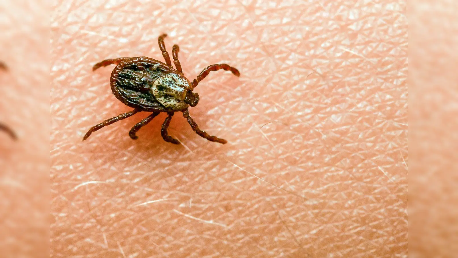 Am häufigsten kommt in Deutschland der Gemeine Holzbock (Ixodes ricinus) als Zeckenart vor. (Bild: Patrick Pleul/dpa)