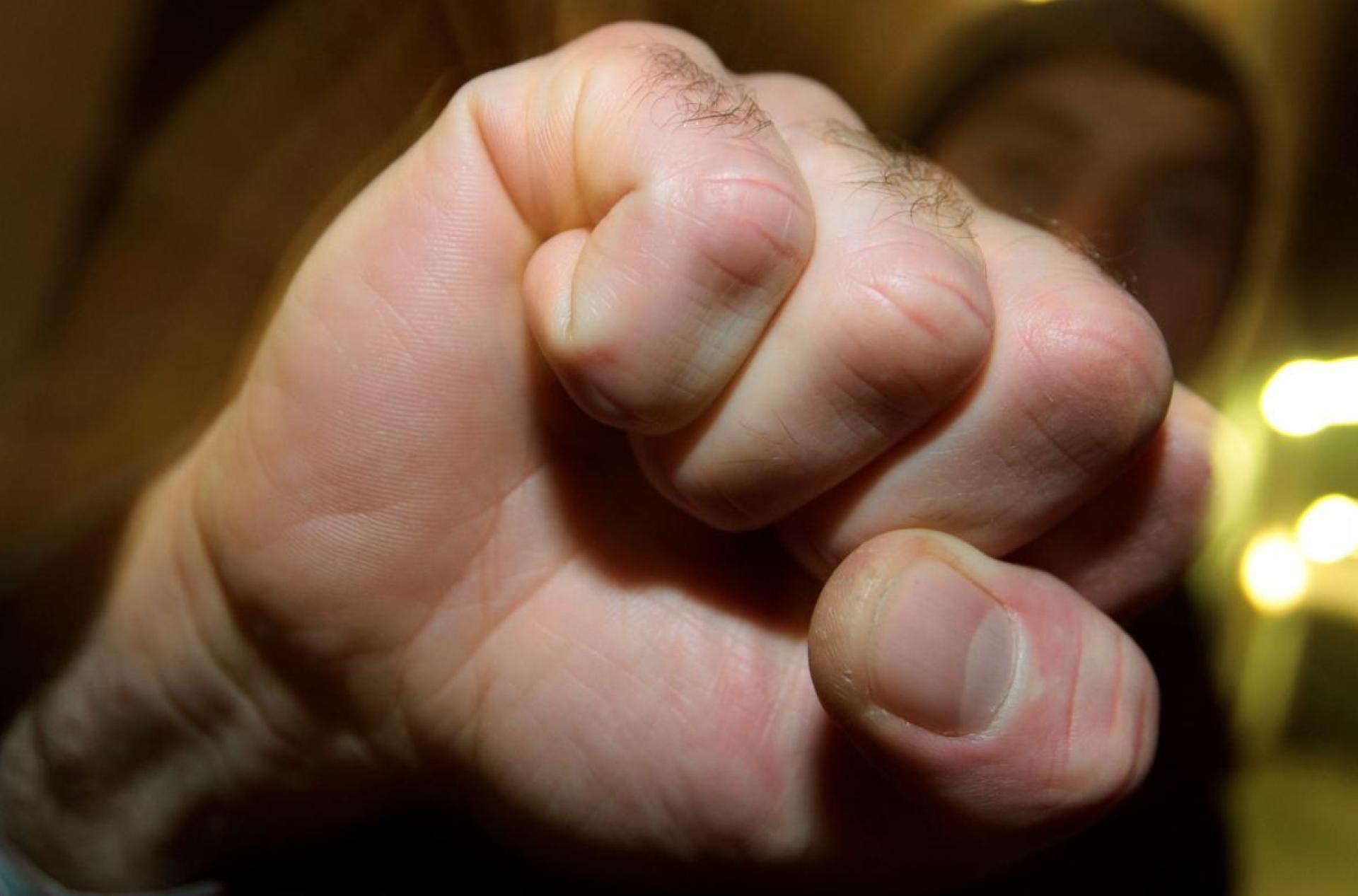 Ein betrunkener Mann attackiert bei der Kirwa in Ursulapoppenricht einen Rollstuhlfahrer und verletzt ihn am Kopf. (Bild: Karl-Josef Hildenbrand/dpa)