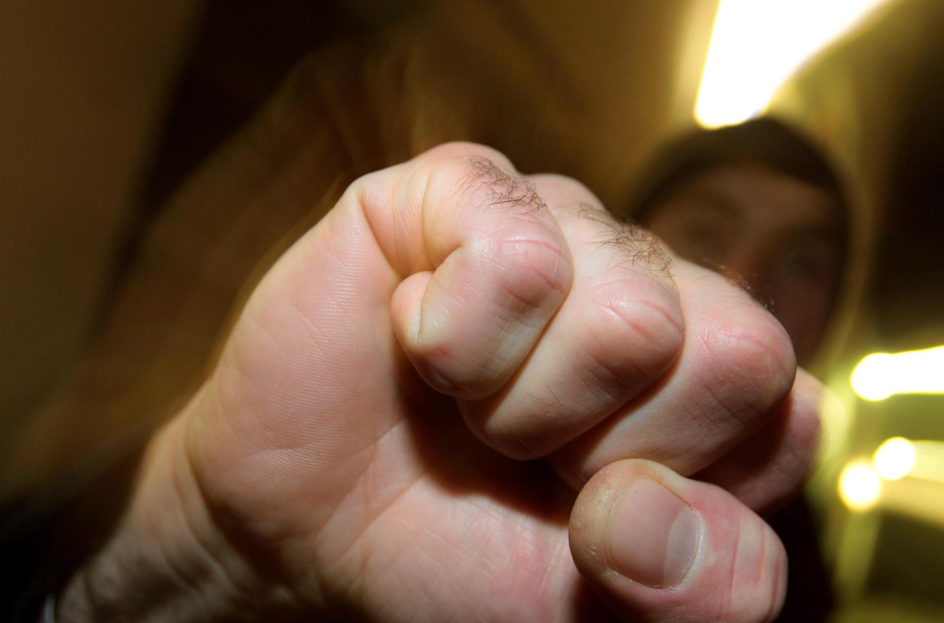 Ein 34-jähriger Mann wurde in Amberg Opfer einer Körperverletzung. Der Täter flüchtete. (Symbolbild: Karl-Josef Hildenbrand/dpa)