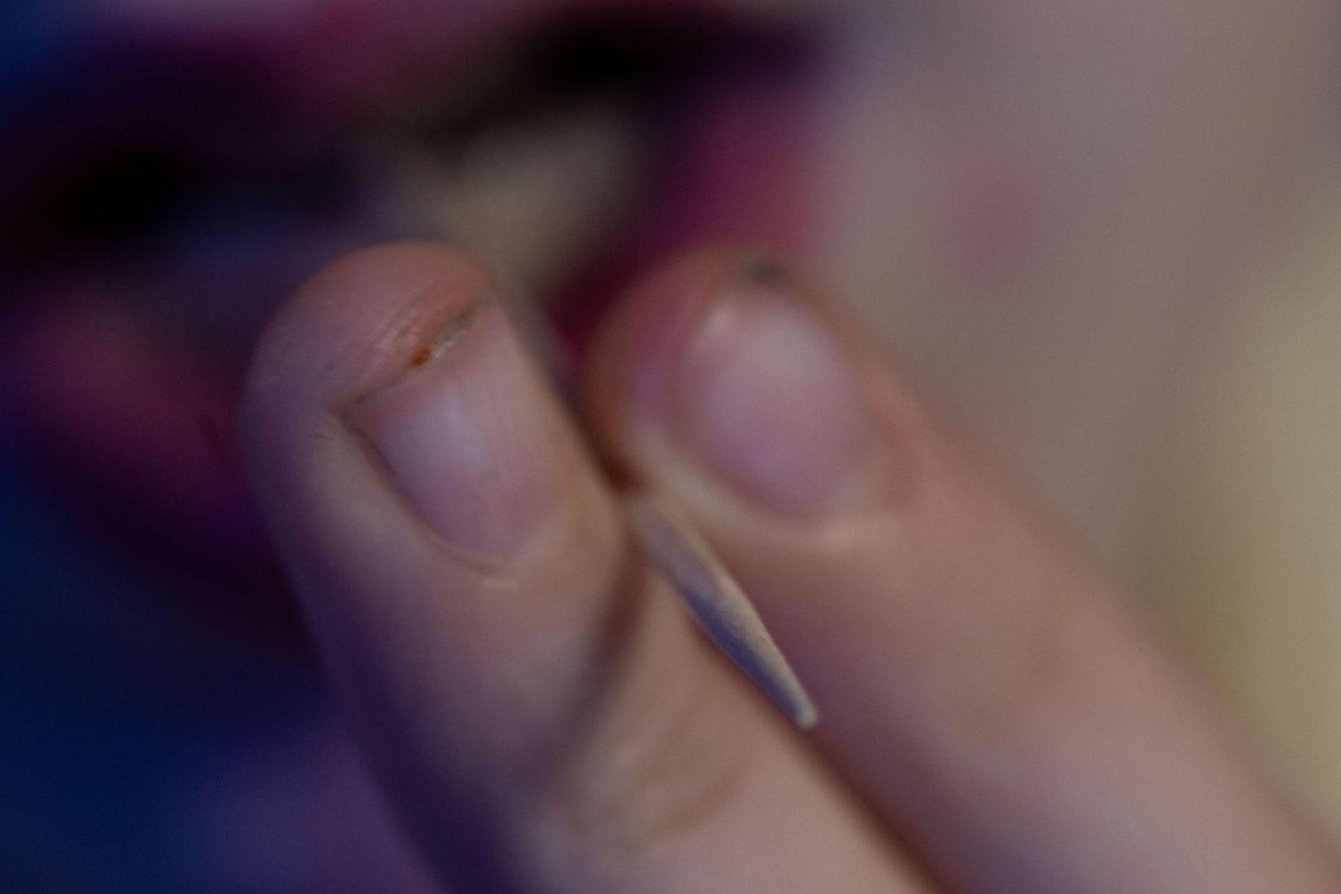 In München hat eine Schule Zahnstocher verboten - aus Gründen. (Symbolbild: Pia Bayer/dpa)